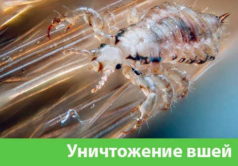 Уничтожение вшей в городе Владикавказ